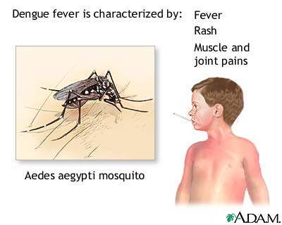 1219381132_CxHMzZDS_dengue-fever